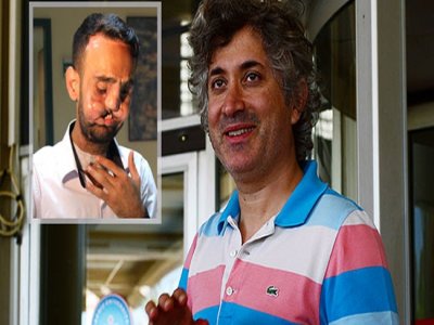 5. Yüz Nakli Yapılan Recep Sert Uyandırıldı
