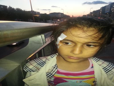 Üst geçit korkuluğuna çarpan küçük kız az kalsın kör oluyordu
